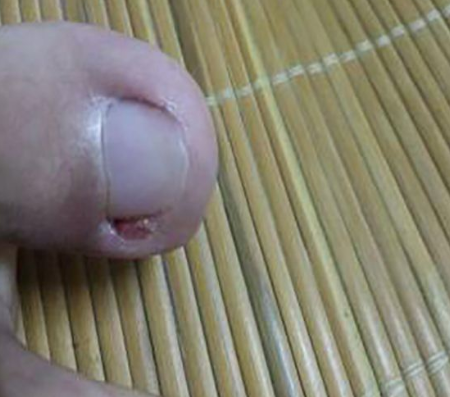 ںõݡ׹